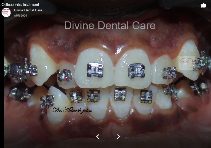 Dental Image