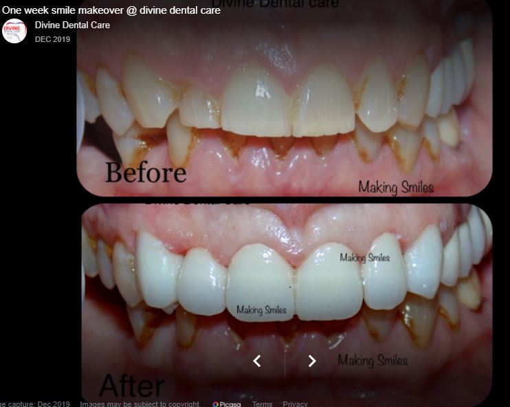 Dental Image